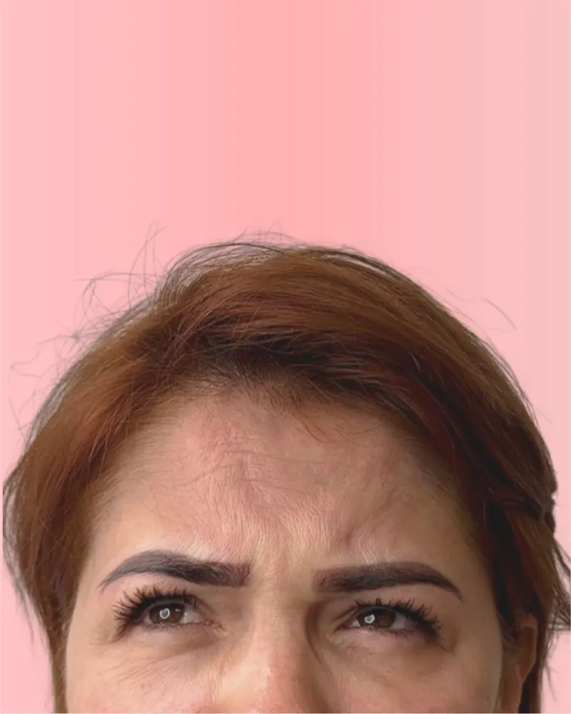 Antes