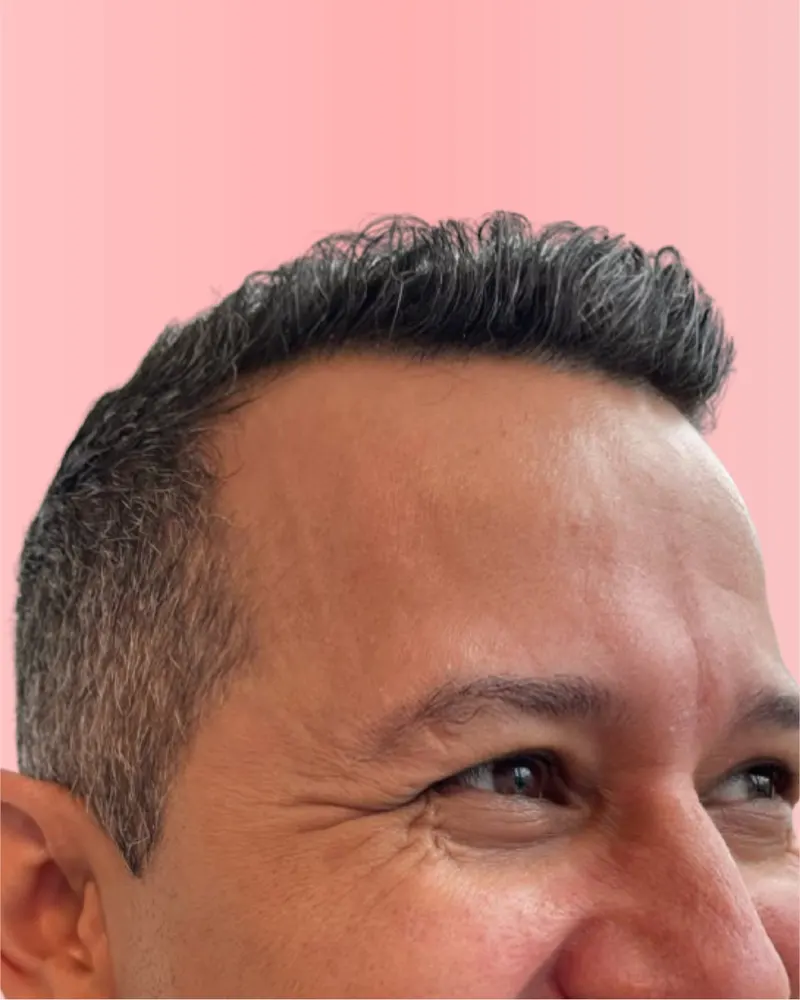 Antes